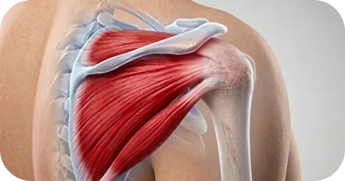 Illustration highlighting improved shoulder strength and stability after successful rotator cuff repair