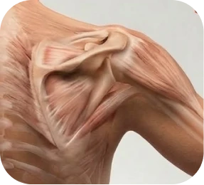 Illustration of rotator cuff muscle atrophy