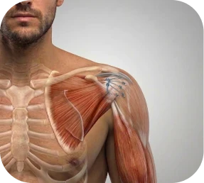 Illustration of rotator cuff repair combined with biceps tenodesis