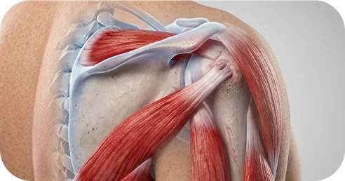 Illustration of tendon transfer concepts for irreparable rotator cuff tears